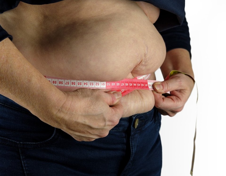 Sobrepeso y obesidad prevalecen en América Latina y el Caribe y superan el promedio mundial tanto en niños como en adultos: ONU